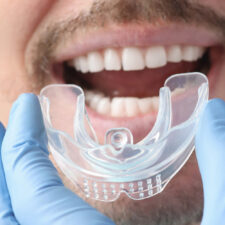 Various Situations Where Mouthguards Prove Beneficial for You