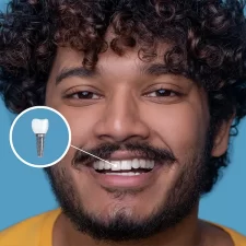 Restore Your Smile with Confidence: Dental Implants Explained